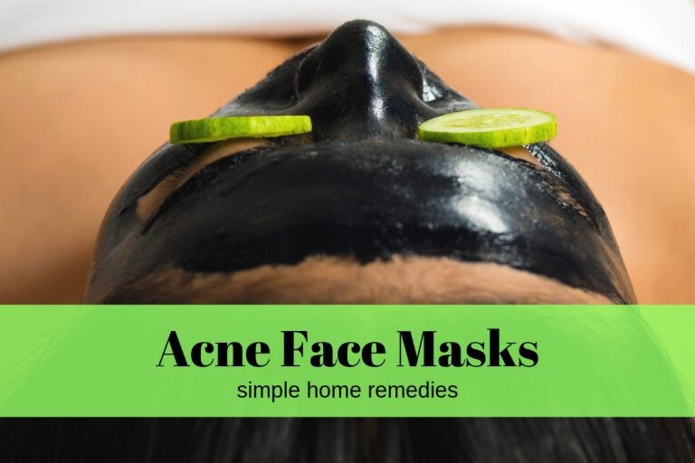 Home Remedies For Acne | 5 Easy-To-Make Face Masks