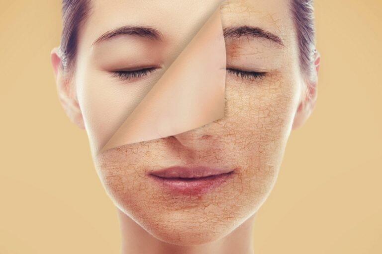 Skin Care Routines | Tips For Dry Skin Care
