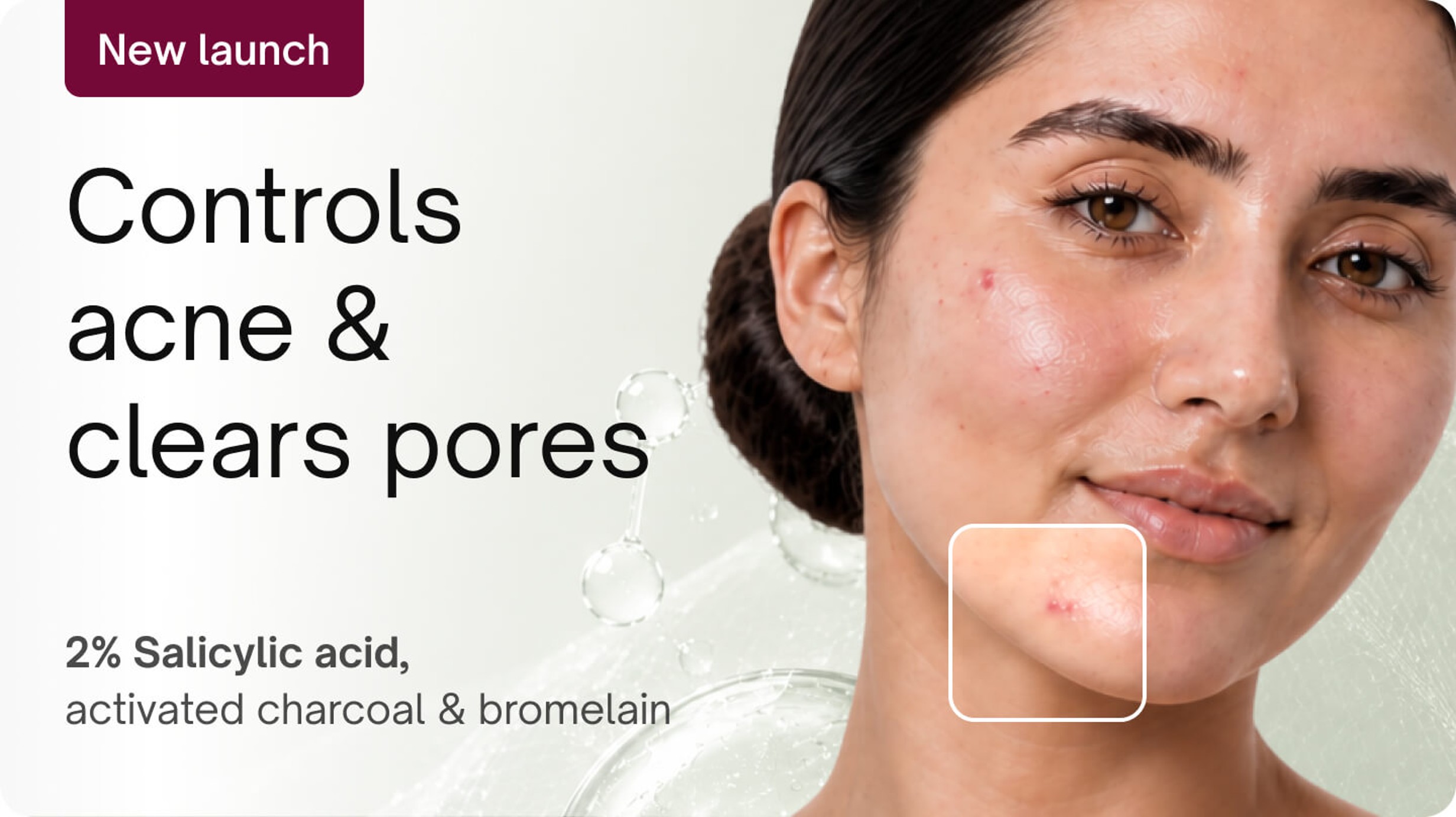 Derma facials - Salicylic acne clarifying derma facial