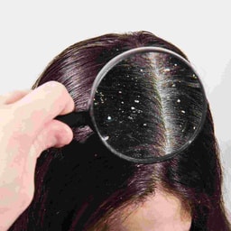 Hair treatments - Scalp Advance Treatment