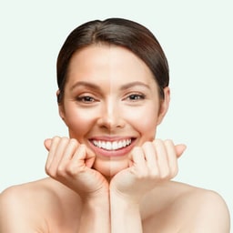 Facial & cleanup - O3+ Tan Removal Facial