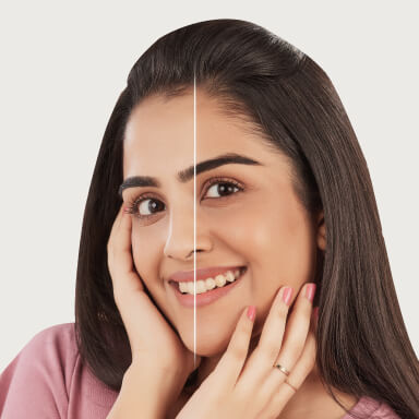 50 Shades Of White – The Obsession With Fair Skin