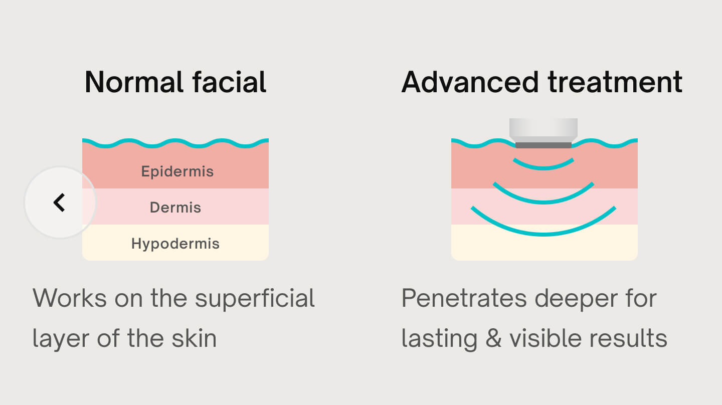 HydraDerma facials & treatments 4