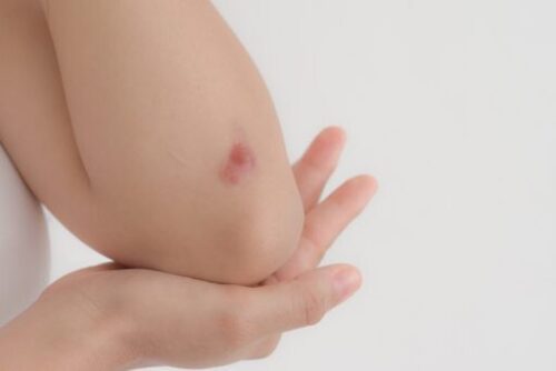 cure the cuts before waxing